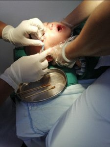 现身图说眼疾:麦粒肿